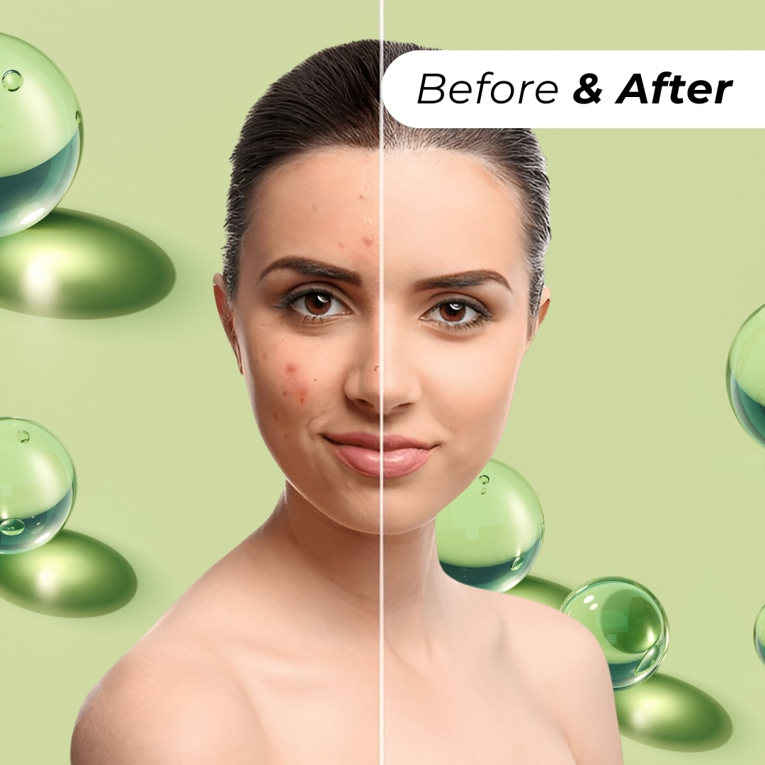 Neem & Aloe Vera Facewash with Vitamin E - 200ml - Image 4